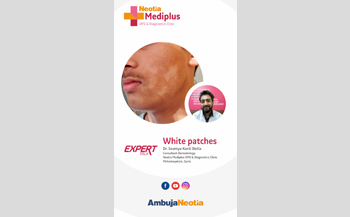 Understanding White Patches: Expert Talk by Dr. Soumya Kanti Datta