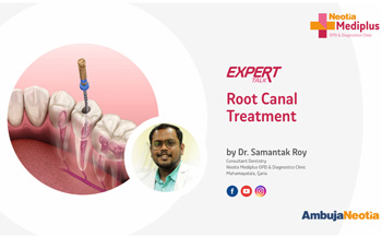 Expert Insights on Root Canal Treatment | Dr. Samantak Roy